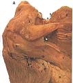 Click image for larger version

Name:	shoulder1.jpg
Views:	159
Size:	47.1 KB
ID:	63395