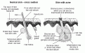 Click image for larger version

Name:	acne.gif
Views:	97
Size:	37.9 KB
ID:	63595