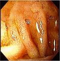 Click image for larger version

Name:	villi.jpg
Views:	67
Size:	10.5 KB
ID:	63685