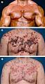 Click image for larger version

Name:	acneroids.jpg
Views:	160
Size:	10.9 KB
ID:	63963