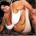 Click image for larger version

Name:	obese-fat-woman.jpg
Views:	87
Size:	71.3 KB
ID:	64198