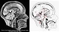 Click image for larger version

Name:	brain1.jpg
Views:	310
Size:	114.2 KB
ID:	64395