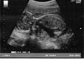 Click image for larger version

Name:	Boris2.jpg
Views:	160
Size:	143.9 KB
ID:	64634